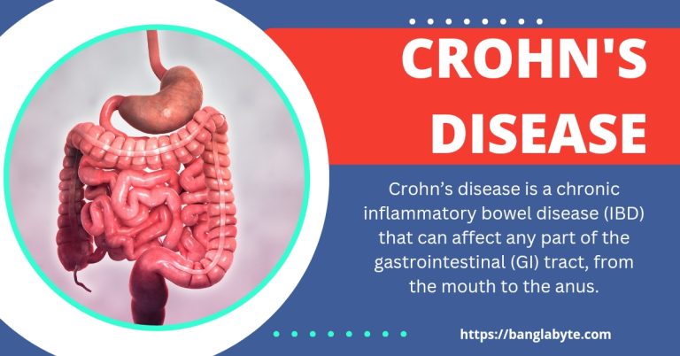 crohn's disease